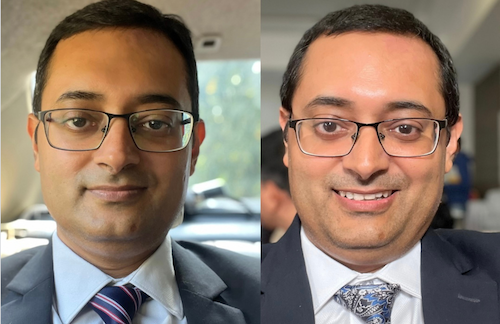 Dr. Sengupta Facial Transformation